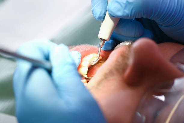 Best Emergency Treatment for Toothache in Spencer, WV