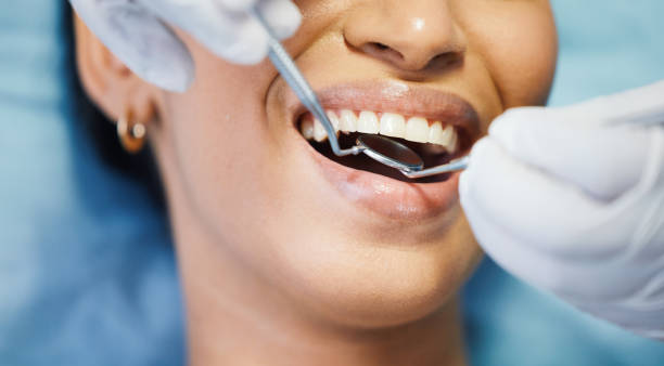 Best Walk-In Emergency Dentist in Spencer, WV