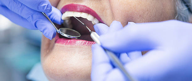 Best After-Hours Emergency Dentist in Spencer, WV